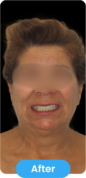 After Image