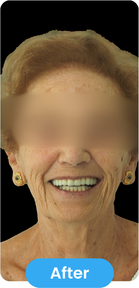 After Image